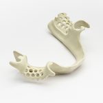 Ultaire AKP Frame Without Teeth